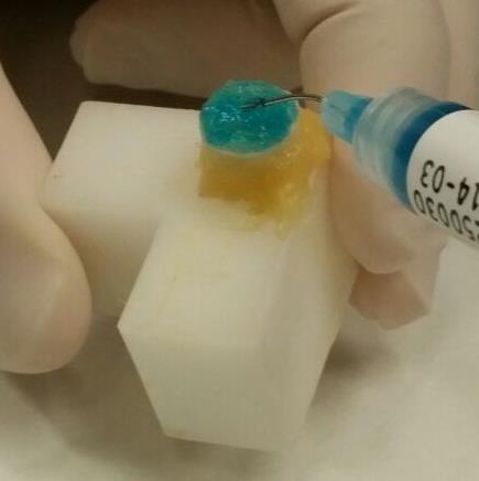 Estudo in vitro da resistência adesiva, por microtração, de um novo sistema adesivo de ionómero de vidro modificado por
