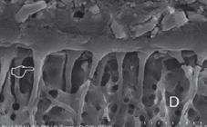 Estudo in vitro da resistência adesiva, por microtração, de um novo sistema adesivo de ionómero de vidro modificado por resina superfície (até 1 μm de profundidade), criando as microporosidades