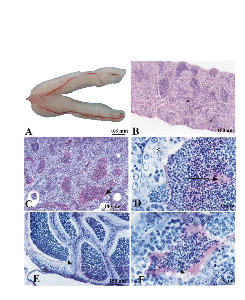 Figure 2: Testes of genera Incertae Sedis in Characidae: Mature testes of M. costae (A). Anastomosing tubular testicle of H. marginatus (B). Acidophilic secretion in the testis of A.