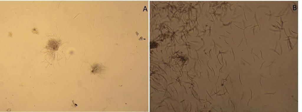 Mancha-de-ramulispora em Sorgo 3 de cultura. No entanto, os esporodóquios podem ser importantes para a sobrevivência quando as folhas infectadas permanecem na superfície do solo.