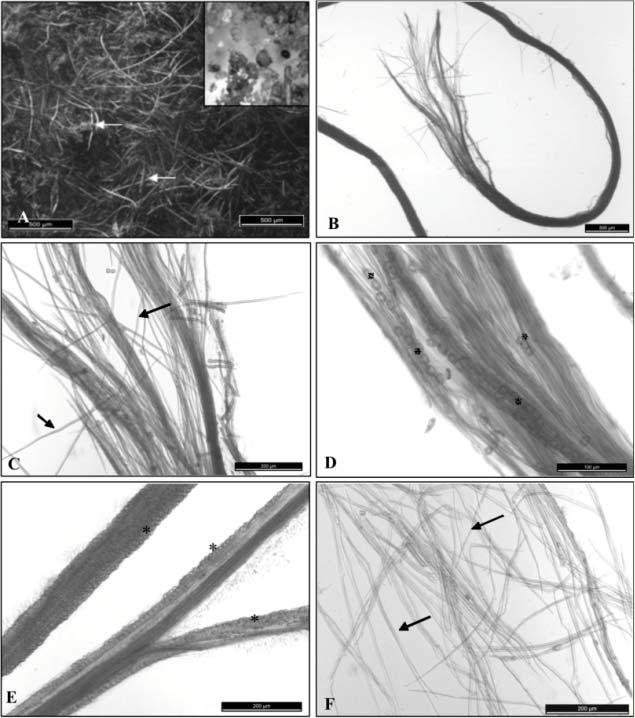 2052 Matos et al. Figura 1 - A-F: Fitobezoar e feixes de fibras da folha de Stylosanthes. Fitobezoar desfragmentado (A); Fibras do fitobezoar (B, C e D); Feixe de fibras de S.