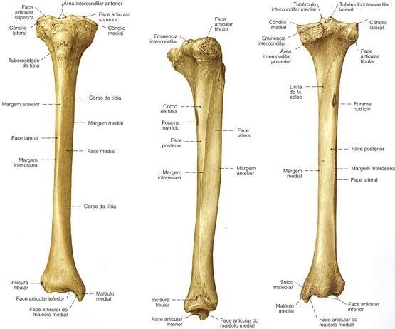 Figura 10 - Tibia [23] A fíbula (Figura 11) está situada na zona exterior da perna e apresenta uma geometria delgada, longa, que se expande nas suas extremidades inferiores e superiores [8], sendo