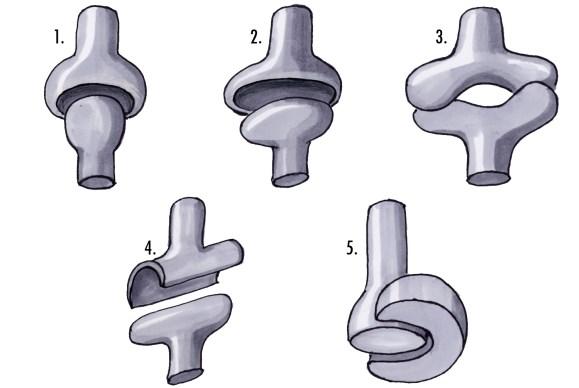 cima Estudo numérico e experimental da articulação do tornozelo Representadas na Figura 13 encontram-se as articulações sinoviais mencionadas em Figura 13 - Articulações Sinoviais [98] Legenda: 1