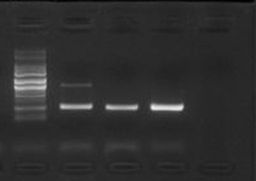 Detecção de Brucella spp. em leite bovino não pasteurizado através da reação de PCR em tubos estéreis de 20 ml e acondicionadas sob refrigeração até a chegada ao laboratório.