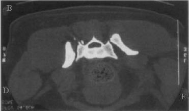 pelve e lesões em tecidos moles intrapélvicos (HUNTER, BRANDSER & TRAN, 1997). No estudo realizado por CRAWFORD et al.