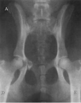 24 Figura 4: Imagem radiográfica em posição ventrodorsal mostrando a única fratura detectável que envolvia acetábulo direito (A).