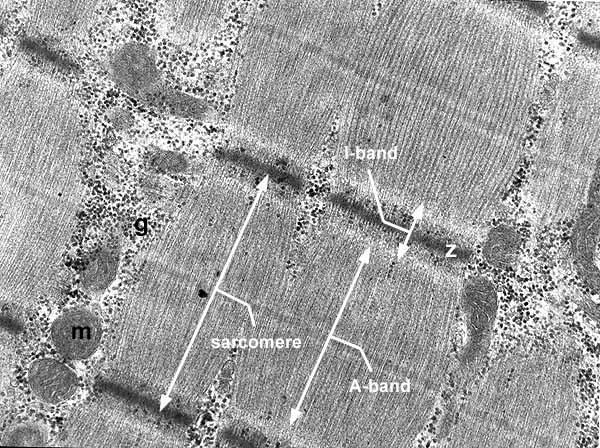 FONTES DE ENERGIA MUSCULAR Mitocôndrias e Glicogênio Micrografia