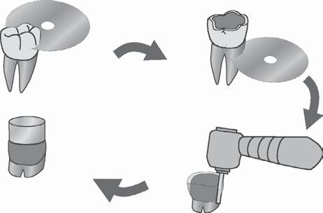 a b d c FIGURA 1 a) remoção da porção oclusal do dente; b) remoção da porção radicular; c) remoção do esmalte periférico; d) construção do bloco de resina.