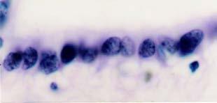 T. Montanari, UFRGS T. Montanari, UFRGS Figura 4.13 - Imagem de parte do corte da medula espinal, onde se observa o canal medular (ou ependimário). HE. Objetiva de 3,2x. Figura 4.14 - Células ependimárias do canal medular.