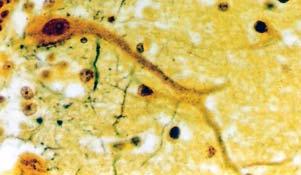 ( ), as quais são neurônios multipolares, cujos dendritos se projetam para a camada molecular, e camada granulosa (G), com neurônios multipolares, os menores neurônios do