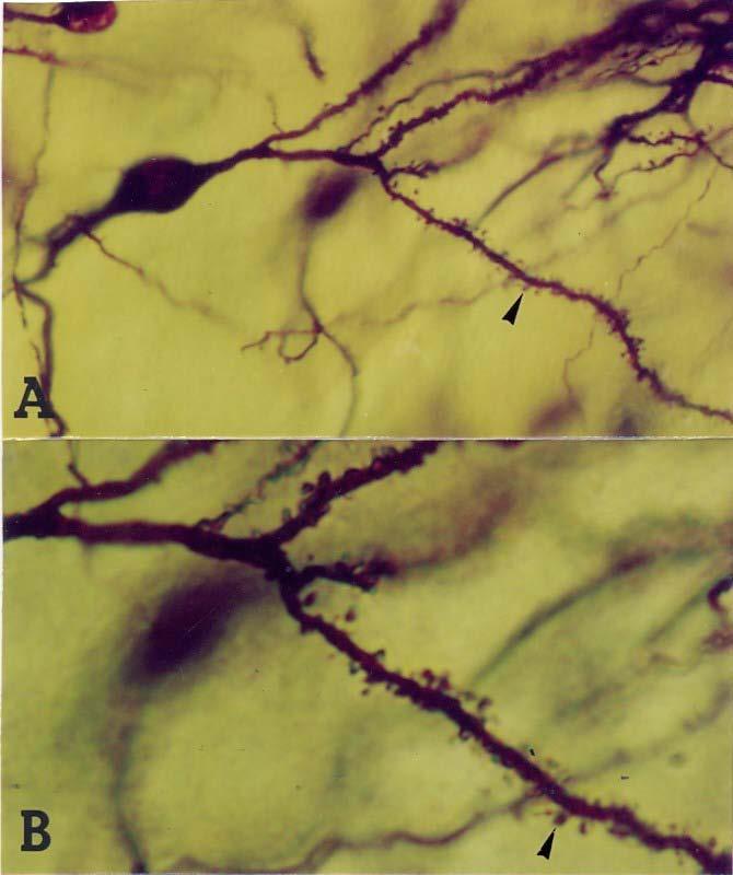 Marcuzzo & Achaval, UFRGS Os dendritos são as terminações aferentes, isto é, recebem os estímulos do meio ambiente, de células epiteliais sensoriais ou de outros neurônios.