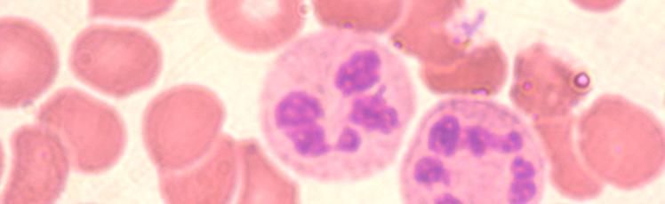 Células do Sangue N FIGURA 13: NEUTRÓFILO (setas)