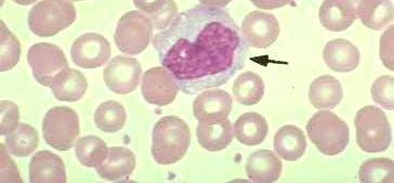 Células do Sangue N N FIGURA 16: LINFÓCITO (setas) Núcleo arredondado (N) e citoplasma não contém grânulos específicos.coloração: Giemsa.