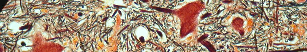 Os axônios mielinizados das células nervosas