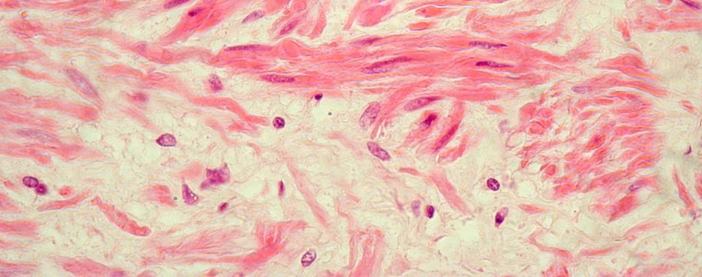 núcleo central. Próstata. Coloração: Hematoxilina-Eosina.