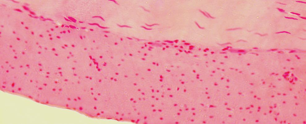 FIGURA 11: Amostra de TECIDO MUSCULAR LISO, apresentando