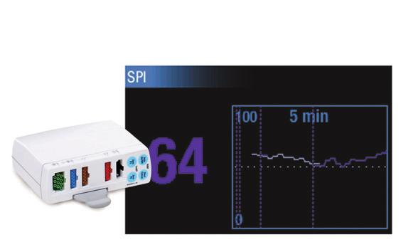 Módulo de Entropia com tecnologia exclusiva para Monitorização Cerebral através de sinais processados do EEG e FEMG. Validado clinicamente para uso adulto e pediátrico.