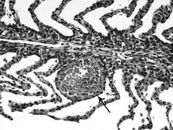 Figura 3 Fotomicrografia de brânquias de Piaractus mesopotamicus com