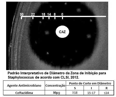 A questão 2 refere-se a figura abaixo. 2. Você identificou a presença de Staphylococcus aureus em uma amostra de secreção purulenta de ferida superficial recebida no laboratório da UFAL.