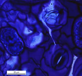 sistema dérmico do tricoma é formado por uma camada de epiderme, que pode conter tricomas tectores simples e glandulares, além de células mucilaginosas e cistólitos, e o tecido sub-epidérmico é