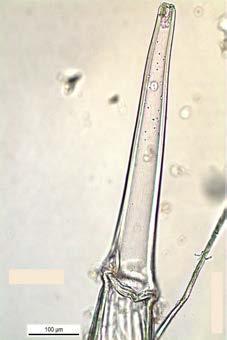 Figura 5 - Tricoma urticante com ponta rompida (A) (100µm) e intacta (B) (200 µm)