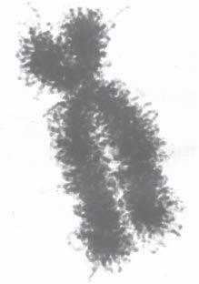 Bases cromossômicas da hereditariedade Alguns pontos do solenóide vão se associar a proteínas não histônicas, formando um filamento em espiral com alças do solenóide presas ao mesmo.