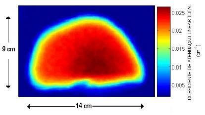 Coeficiente de Atenuação Linear Total (cm -1 ) 43 Campo de visão: é o espaço do tomógrafo onde se posiciona o objeto ou paciente (região de Grantry).