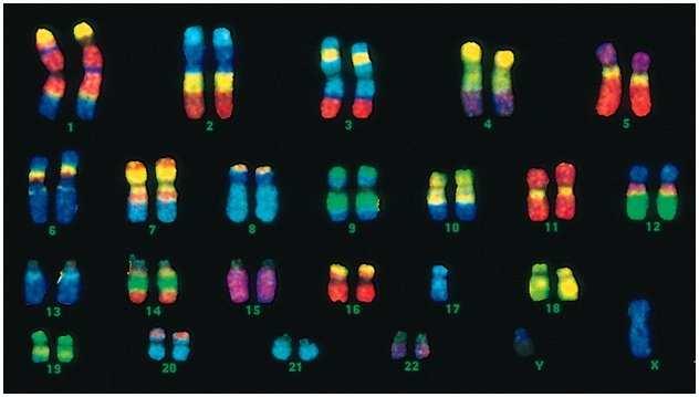 (FISH) Aplicações: Suspeita de microdeleções cromossômicas associadas a síndromes genéticas, - Síndrome de Down (trissomia do cromossomo 21); - Síndrome de Patau (trissomia do cromossomo 13); -