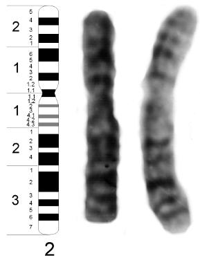 NOMENCLATURA Padronização internacional da nomenclatura de cromossomos São identificados pelo seu tamanho, pela posição do centrômero e padrão de Bandas Cariótipo Humano Nomenclatura A G Grupos