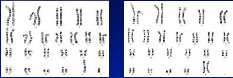 Cariótipo de homem 46, XY