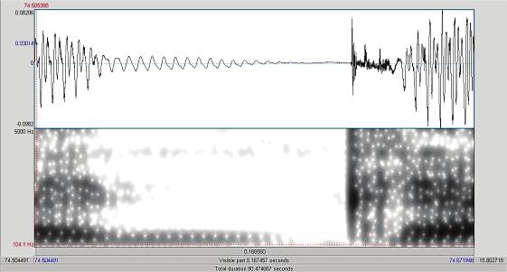 breathy vowel, ausência da barra de sonoridade e bursts múltiplos produção de um sujeito do GA A Legenda: A =