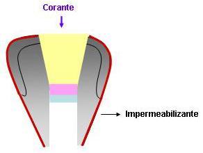 tecido dental), deixando a superfície coronária exposta a penetração do corante (Figura 4.4). 4.4.2.