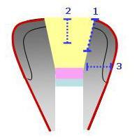 9 Esquema ilustrando a leitura da permeabilidade dentária nos corpos-de-prova dos Grupos I.2 e II.2 4.7.