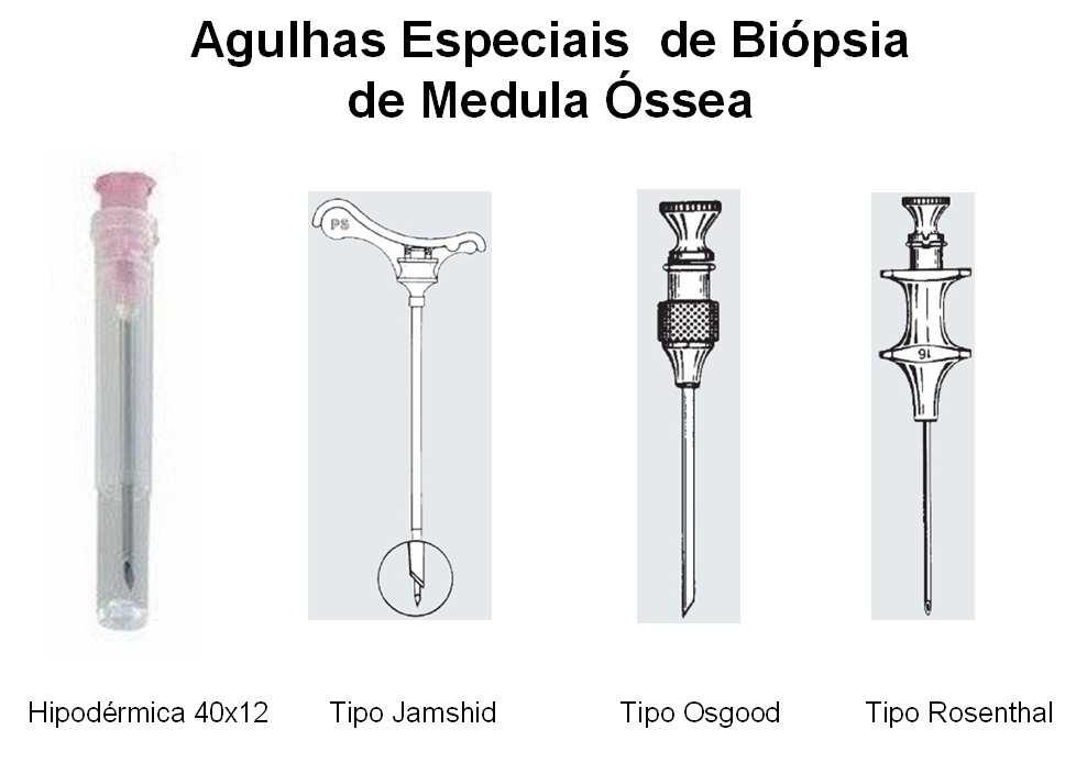 anticoagulante para obtenção do aspirado da medula óssea; - Tubo de coleta com EDTA (tampa roxa); - Lâminas de vidro foscas não lapidadas e limpas, - Placa de