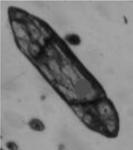 550 CIRO A. ÁVILA et al. Fig. 5 Microscope (A) and cathodoluminescense (B) images of zircon grains from sample CAWT02 (PC-18E M-II facies) of Glória quartz-monzodiorite. the crustal protholith.