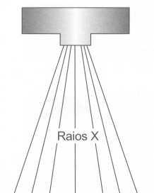 RADIOLOGIA PRÁTICA PARA O ESTUDANTE DE MEDICINA Fig. 1-10.