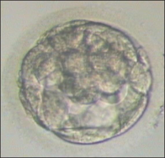 12 selecionados. Mantidos em uma incubadora com o ambiente similar ao das tubas uterinas, 37 C com 5% de CO2, os óvulos ficam por um período de 12 a 18 horas (VAN VOORHIS, 2007).