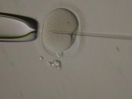 16 taxas de gravidez evolutiva muito mais elevadas (MERCHANT; GANDHI; ALLAHBADIA, 2011). Figura 3. Injeção do espermatozoide no ovócito selecionado.