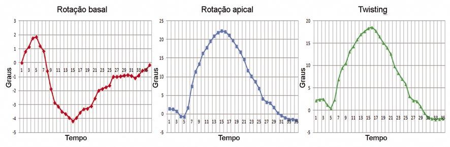 Rev bras ecocardiogr imagem cardiovasc. 2012;25(3):206-213 do VE (média etária 51 ± 8 anos, 7 do sexo masculino e 5 do sexo feminino).