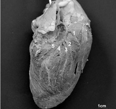 segmento arterial ventricular dorsal esquerdo (SADE). Figura 3. Fotografia da margem cranial (face atrial) do coração de caprino SRD.