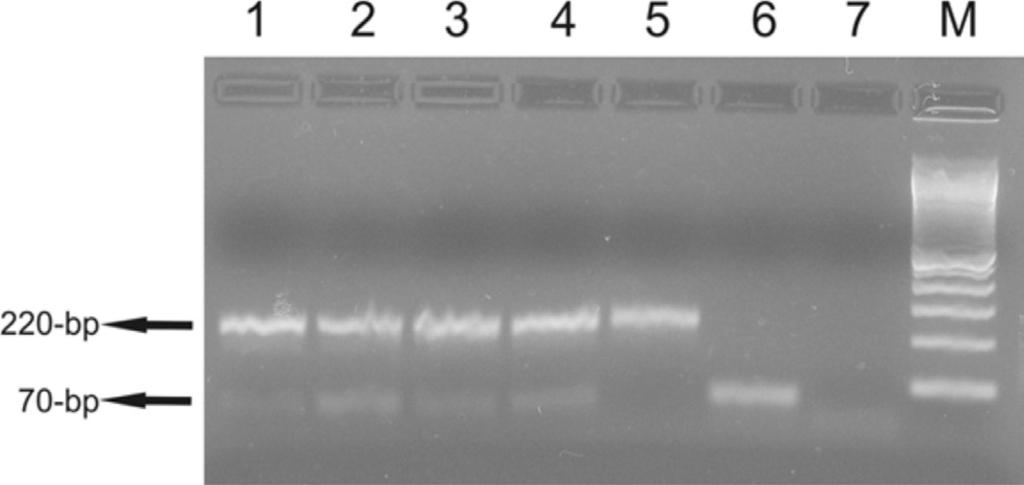 The advantage of employing the multiplex PCR technique is that, in addition to the primers for detection of Leishmania (Viannia), the pair of primers used for internal control can assess the presence