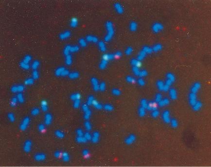 rdna e para 5S rdna x = 10 45S