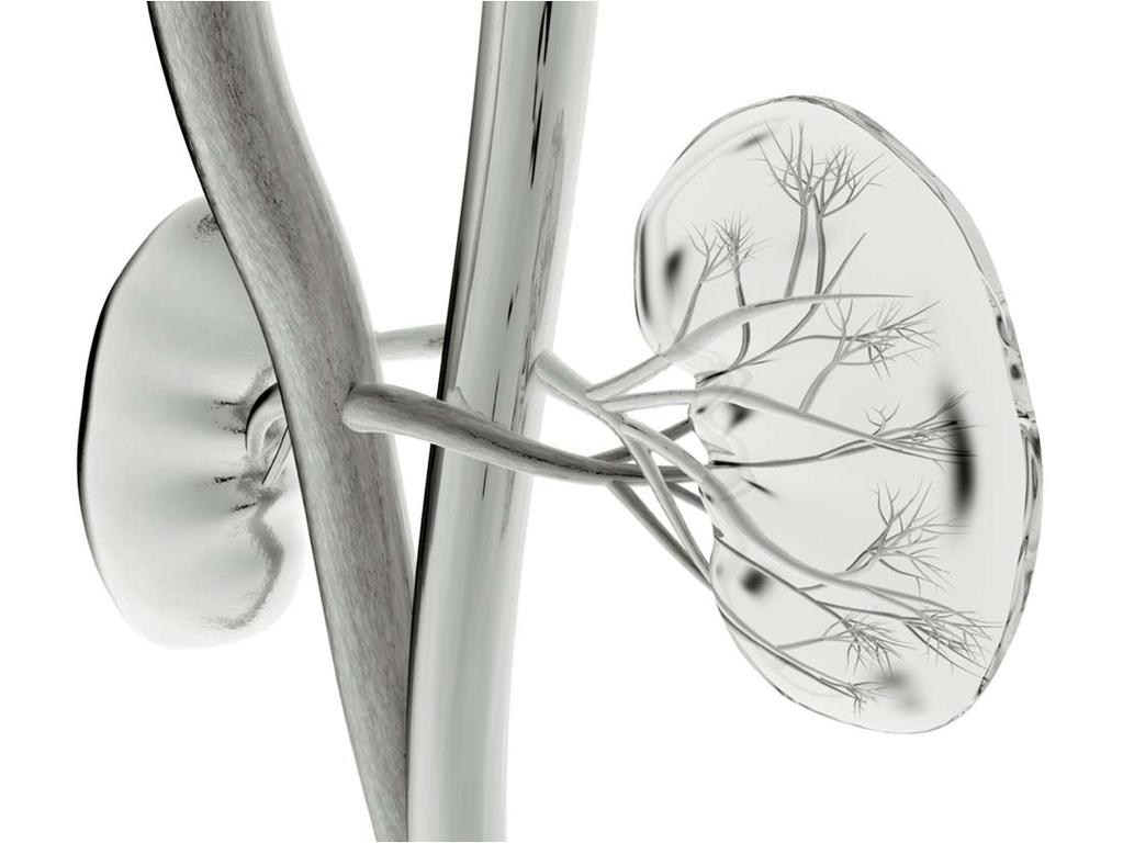 ABORDAGEM E OPÇÕES TERAPÊUTICAS NO DOENTE COM LITÍASE RENAL Módulo 1 Palestrante: Dr.