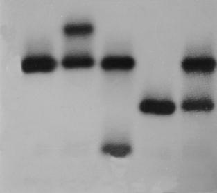 Rev.bras.hematol.hemoter., 2000, 22(1): 05-22 Naoum P.C. Figura 1. Mutação no gene da globina beta S do cromossomo 11.