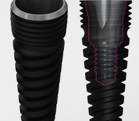 Doble rosca: Microrrosca cervical y roscas trapezoidales en el cuerpo del implante, más estabilidad primaria y mejor integración ósea.