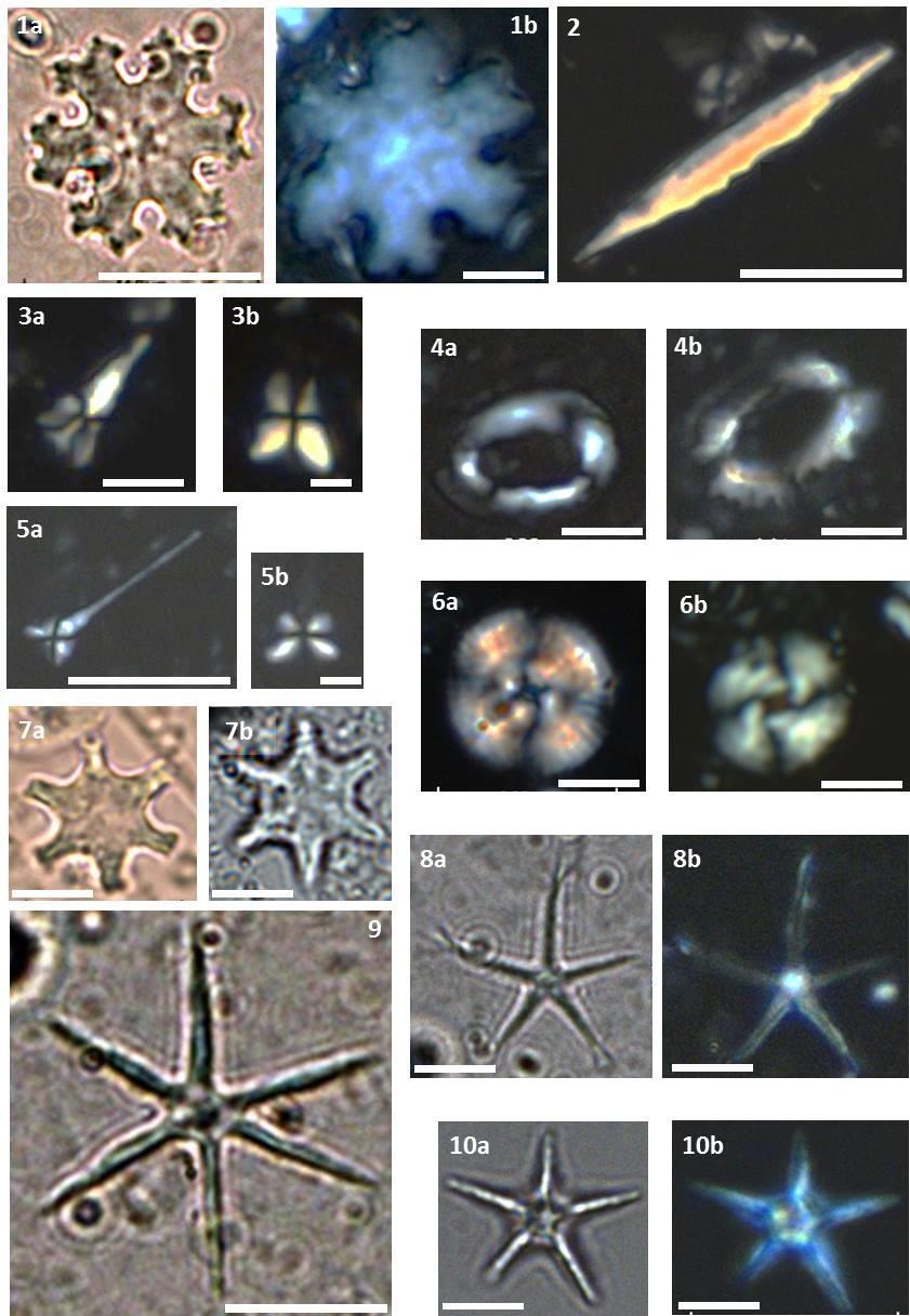 Estampa 3. Espécies de nanofósseis calcários usadas para delimitar biozonas do Mioceno (N547 a N640) na MCB. 1. Discoaster calculosus (a. PPL; b. mesmo espécime XPL). 2.