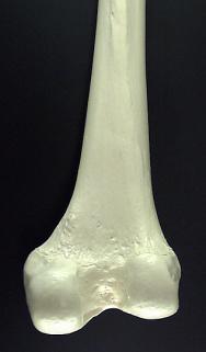 Os dois côndilos estão unidos anteriormente pela superfície anterior distal do fémur e quando, vistos posteriormente, estão separados pela troclea femoral (figura. b e c).