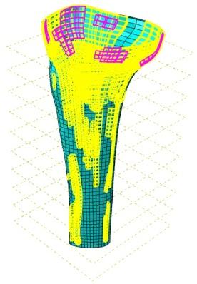 cortical; d) Malha hexaédrica gerada no osso