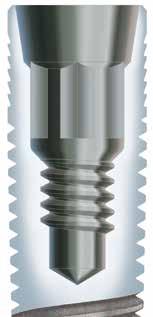 O hexágono interno tem 2,1 mm entre os lados e uma profundidade de 1,7 mm (Fig. 2A e 2B).