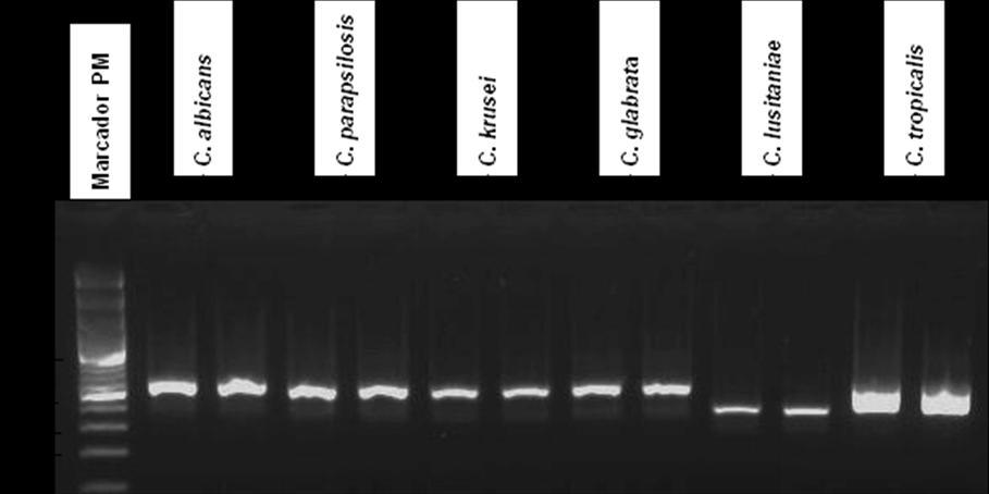 Tabela 23: Tamanhos das bandas da região ITS do DNA ribossómico de diferentes espécies do género Candida e tamanho das bandas após restrição com enzima MspI.